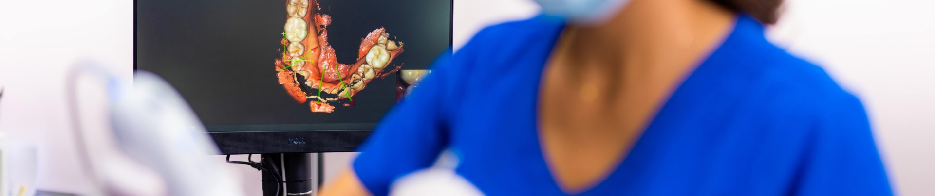 prothese dentaire cabinet Arcades Champigneulles